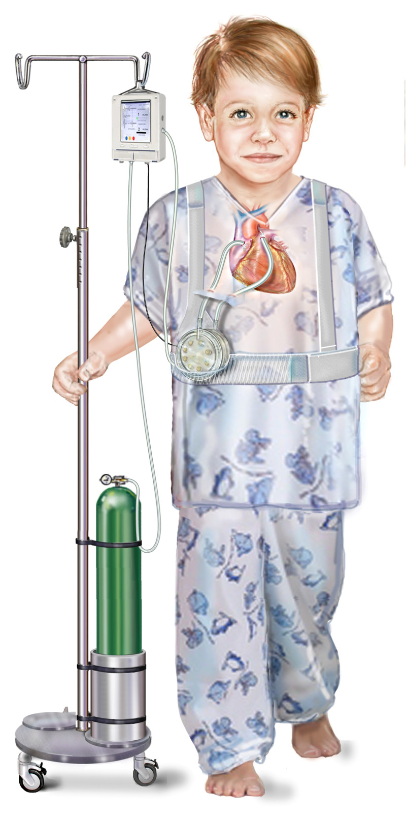 Engineering researcher at MSU helps design artificial lung device